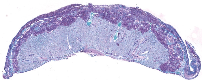 side scan of a placenta